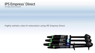 IPS Empress Direct – The material for highly esthetic fillings [upl. by Celik]