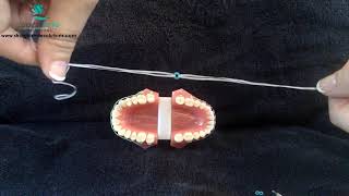 Digital Education Orthodontic Spacers and Separators httpswwwstraightsmilesolutionscom [upl. by Kare]