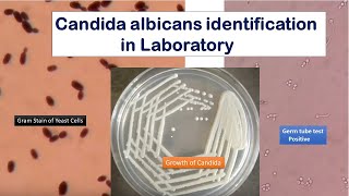 Candida growth on SDA Gram stain and Germ tube test Positive [upl. by Yraeht]