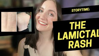 hell on earth the lamictal rash STORYTIME [upl. by Shepley975]