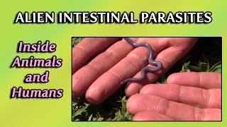 Alien Intestinal Parasites Inside Animals and Humans  Dr Robert Cassar [upl. by Lyreb]