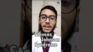 Stevens Johnson Syndrome  Sulfonamide  Penicillin  Antibiotics  Adverse effects [upl. by Katlin279]