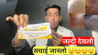 सचाई जानलो  Kojivit ultra gel  Kojivit ultra review  Kojivit ultra cream results  kojivit gel [upl. by Tait541]