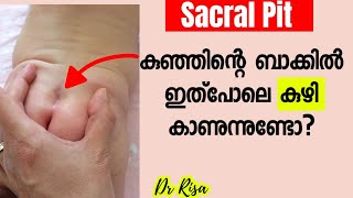 കുഞ്ഞുങ്ങളുടെ പുറകിൽ കുഴിപോലെ ഉണ്ടോ Sacral Pit Malayalam Baby Care Tips [upl. by Selina]