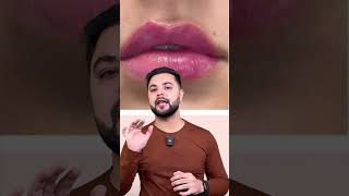 Transform Your Lips 100 Effective Dark Lip Pigmentation Treatment at Home [upl. by Brnaby]