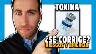 🔵 TOXINA BOTULÍNICA para ESTRABISMOS ¿es efectiva [upl. by Aibar]