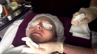 NeoStrata Glycolic Skin Peel  Outline Clinic Droitwich Worcestershire UK [upl. by Bertelli940]