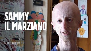 Sammy Basso una vita con la progeria quotStudio una ricerca per fare del bene agli altriquot [upl. by Dodwell]