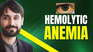 Hemolytic Anemia  Causes  Symptoms  Diagnosis and Treatment  MLT Hub with kamran [upl. by Valenta]