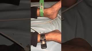 ECG procedure  Electrocardiogram ecg shorts doctor nurses cardiology reels feed ytshorts [upl. by Refinnaj]