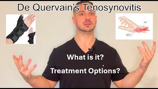 De Quervains Tenosynovitis Patient Education and Treatment [upl. by Neved]