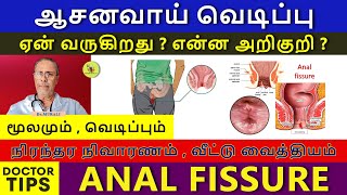 FISSURE  CAUSES SYMPTOMS amp TREATMENT HOME REMEDIES PILES AND FISSURE [upl. by Sylram]