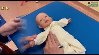 GUIDELINES OF HOME EXERCISE FOR BABY WITH ERB’S PALSY [upl. by Kimble]