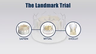 LANDMARK trial Early outcomes of a randomised noninferiority trial comparing TAVI devices [upl. by Sukey]