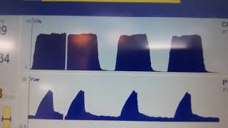 الحلقة  42   شاشة المراقبة والضبط setting and monitoring [upl. by Cattima]