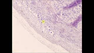 Myenteric plexus Duodenum [upl. by Ysteb]