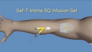 How to Insert SafTIntima™ SQ Infusion Set [upl. by Sone447]