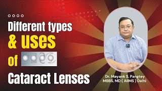 Different types amp uses of Cataract Lenses  IOL lenses  Cataract Lenses [upl. by Alphonse887]