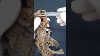 LARINGE PARTE 8  Anatomia humana Shorts medicina anatomia aula anatomy biologia [upl. by Aelsel]