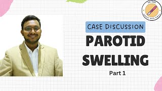 PAROTID SWELLING Case Discussion Part 1Surgery Made SimpleSMS by NBK [upl. by Greenwood]