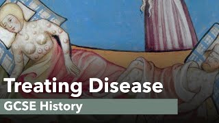 Treating Disease  GCSE History [upl. by Hollis]