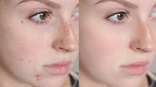 How To Remove Acne amp Make Smooth Skin Using Portraiture In Photoshop CC 4K  Surendra Devagan [upl. by Herrah]