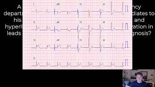 Cardiology Basics 1 [upl. by Otha178]