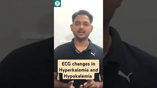 ECG changes in Hyperkalemia and Hypokalemia motivation bscnurshing education nurseducator study [upl. by Nihs485]