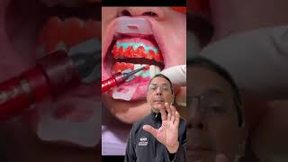 FAST Teeth Whitening In Office Procedure with Opalenscence  View Mobile Dental [upl. by Aibonez627]