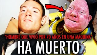 MUERE EL HOMBRE que vivió 70 años en UN PULMÓN DE ACERO [upl. by Adalbert]