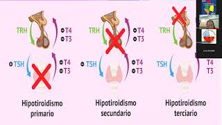 Video 6º Módulo ENDOCRINOLOGÍA Patología Tiroidea  Curso NOA 2024 [upl. by Ojeitak]