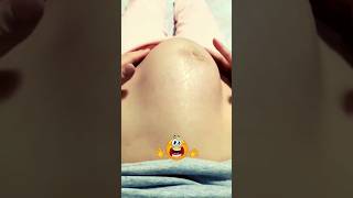 Fetal Movement 😅 pregnancy fetus share [upl. by Joaquin]