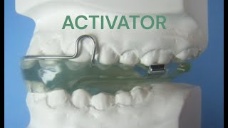 Activator Appliance Therapys Impact in Orthodontics [upl. by Papst464]