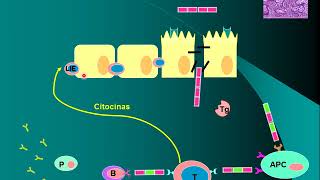 Enfermedad celiaca fisiopatología [upl. by Crandell]