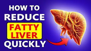 I Cured My Fatty Liver in 30 Days and You Can Too [upl. by Dygal]