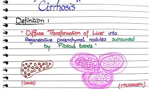 Cirrhosis of Liver  Pathology [upl. by Kissie]