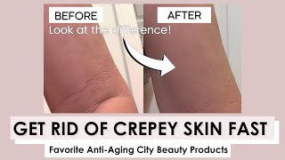 GET RID OF CREPEY SKIN FAST [upl. by Wanyen]