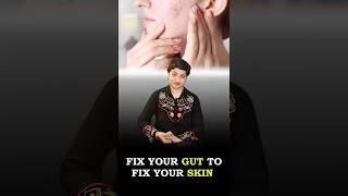 The Link Between Digestive Health amp Clear Skin Connection Between Acne Gut Health amp Skin Problems [upl. by Sheffy114]