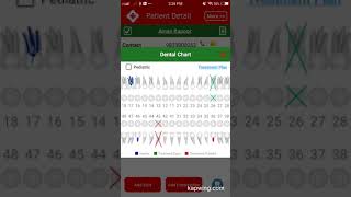 Dental Charting in App Module [upl. by Kohn]