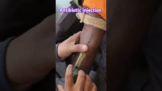 monocef antibiotic injection short video trending doctorsadvice13 [upl. by Alac]