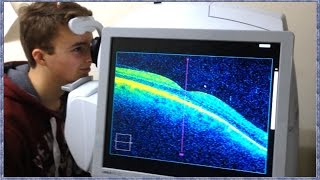 What is OCT Scanning Optical Coherence Tomography [upl. by Netsrak]