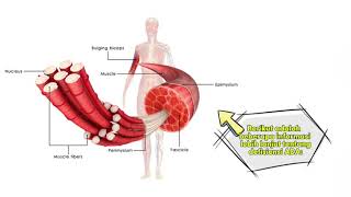 Defisiensi Adenosin Monofosfat Deaminase ADA [upl. by Hollington]