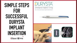 Simple Steps for Successful Durysta Implant Insertion [upl. by Yriek451]