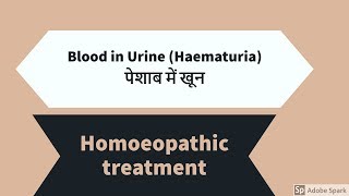 पेशाब में रक्त का कारण Blood in Urine Haematuria homoeopathic treatment [upl. by Mihar492]