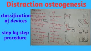 Distraction Osteogenesis partII [upl. by Dnaletak949]