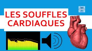 ❤ Souffle au coeur écoutez les bruits cardiaques anormaux auscultation audio cours cardiologie [upl. by Ardiek860]