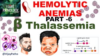 Hemolytic Anemias Part 6 Beta Thalassemia Pathogenesis types Diagnosis amp Treatment [upl. by Mirielle]