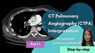 CT Pulmonary Angiography CTPA Interpretation  Part 1 [upl. by Peterson]