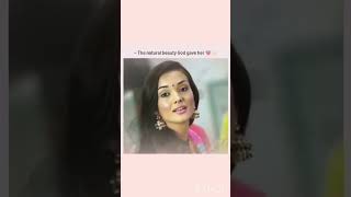 Plastic surgery made him 🤢bollywood plastic bollywood song love newsong bollywoodsongs [upl. by Llerrehs]