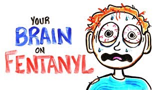 Your Brain On Fentanyl FIXED [upl. by Atteval]